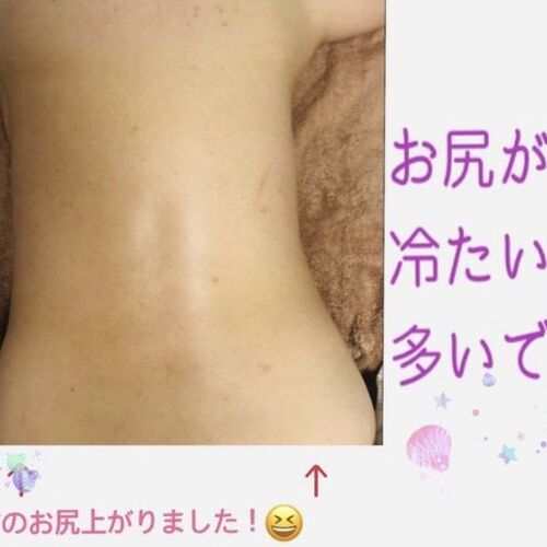 お尻