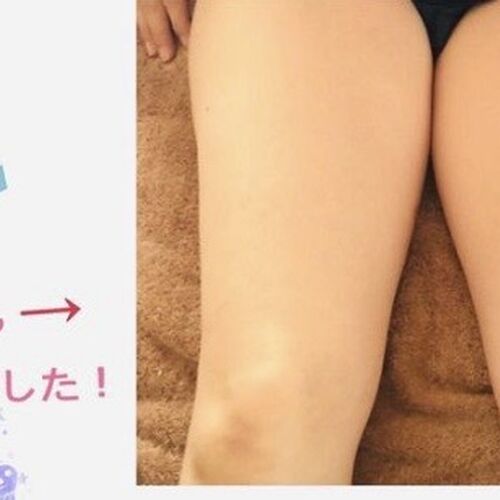 ふともも