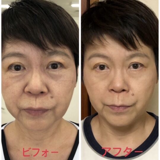 わたし